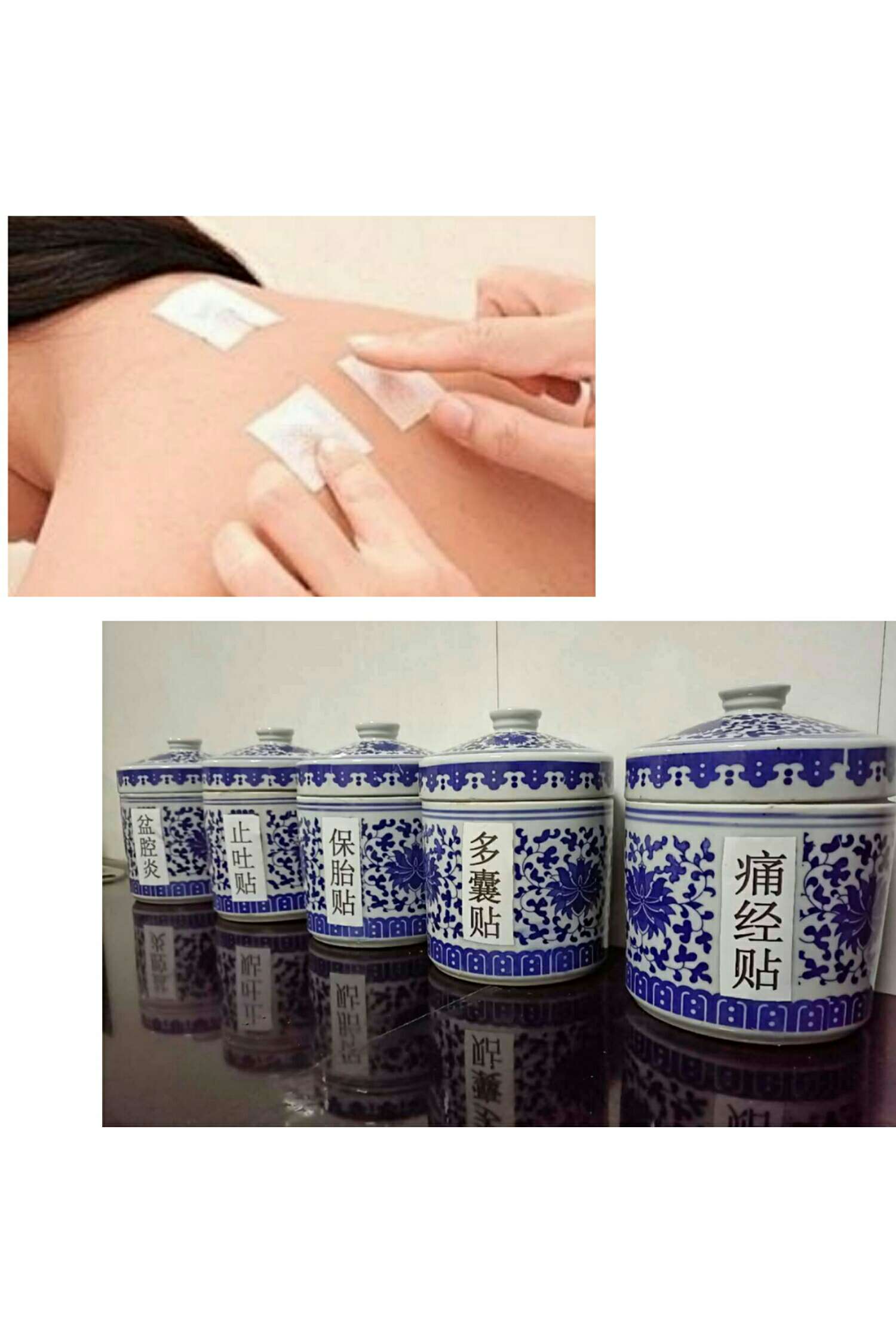 1、三伏貼能治什么??？